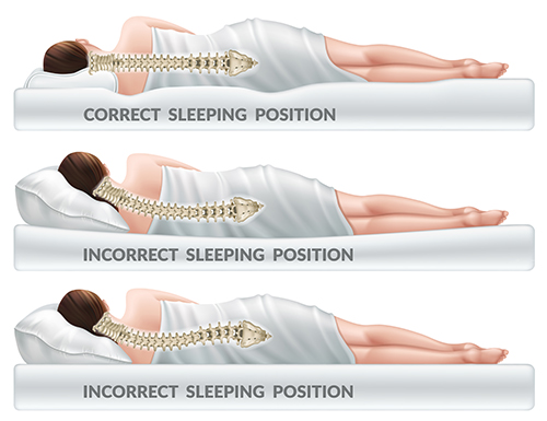 就寝後の腰と腰の痛み：原因と治療