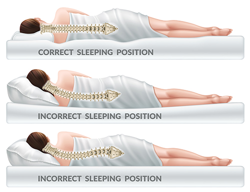 Sleeping Positions for Back and Neck Pain Edison Spine Center